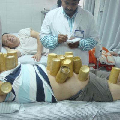 Acupuncture Courses in Kerala: Your Guide to Alternative Healing 7 Needle Institute Calicut – Clinical Diploma Acupuncture